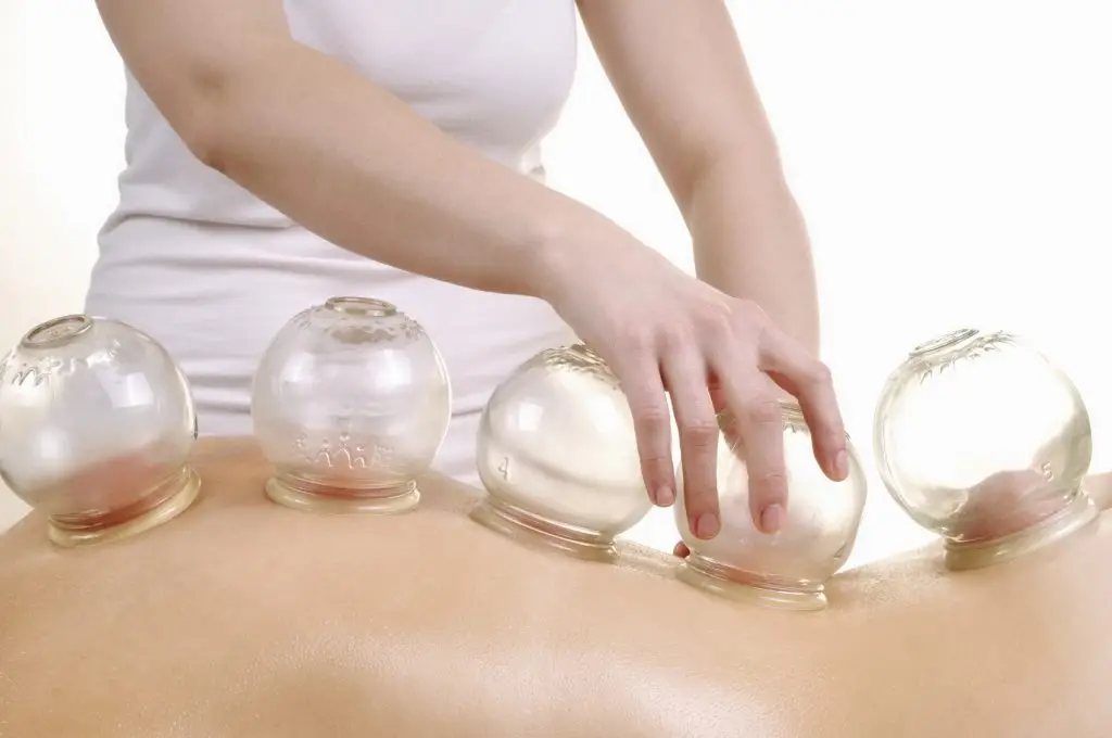 Cupping Massage with glass cups